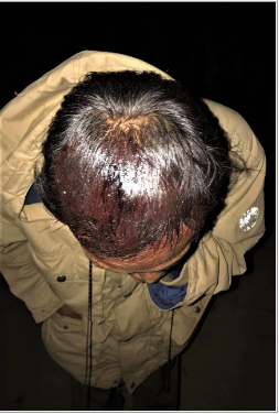 Six Christians Injured in Stoning of Christmas Service in Burma